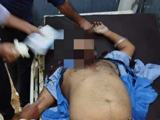 बारामा गोली चल्यो, प्रिन्सिपल घाइते