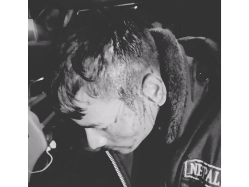 विवाद मिलाउन गएका प्रहरीमाथि नै आक्रमण, दुई जना घाइते