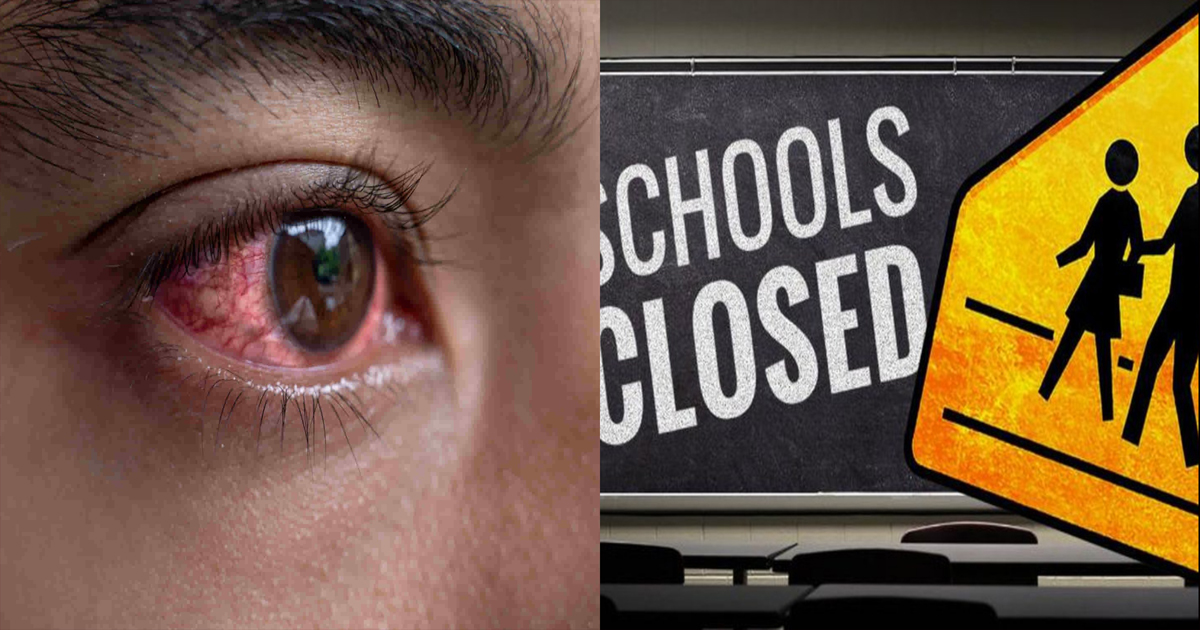 आँखा पाक्ने समस्या देखिएपछि चितवनमा दुई दिन विद्यालय बन्द